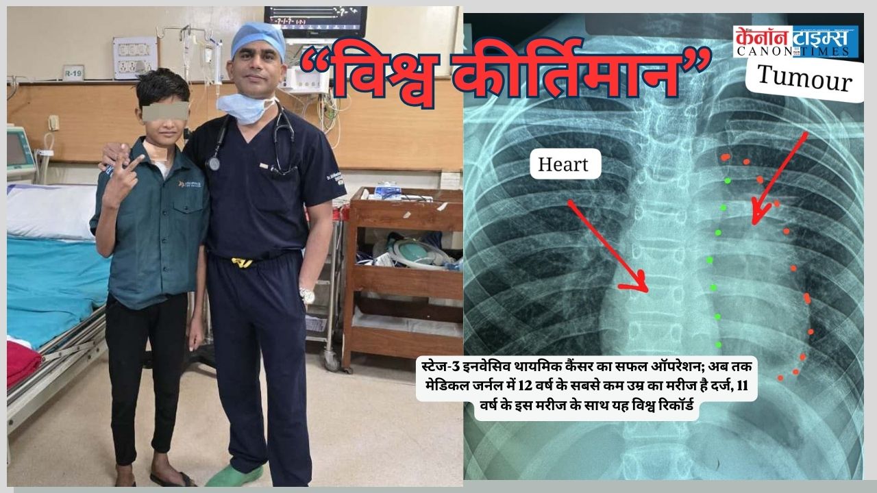 Ambedkar Hospital Sets Global Record: 11 Year Olds Rare Thymic Cancer Triumph